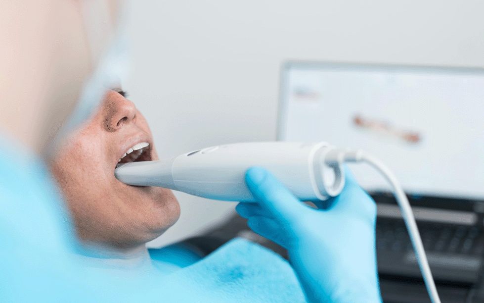 Intraoralscan beim Patienten im Behandlungsstuhl, der digitale Abdruck erscheint auf dem Bildschirm
